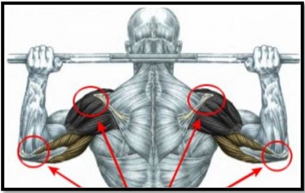 Нагрузка на мышцы пляча і локця - адна з прычын артрозу плечавага сустава